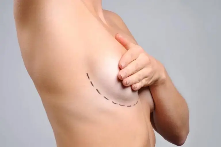 Reconstrução Mamária